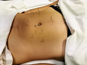 How I Really Healed My Gut: A Complete Nervous System Reset